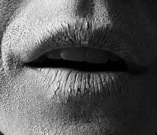 Was tun bei spröden, aufgesprungenen und rauen Lippen?