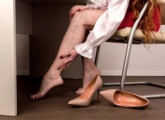 Besenreiser und Couperose – was hilft dagegen ? Bei Couperose und Besenreiser differieren die Meinungen